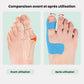 Tape pour Hallux Valgus | Soulagement & Correction - Semello.fr