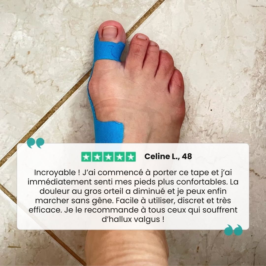 Tape pour Hallux Valgus | Soulagement & Correction - Semello.fr